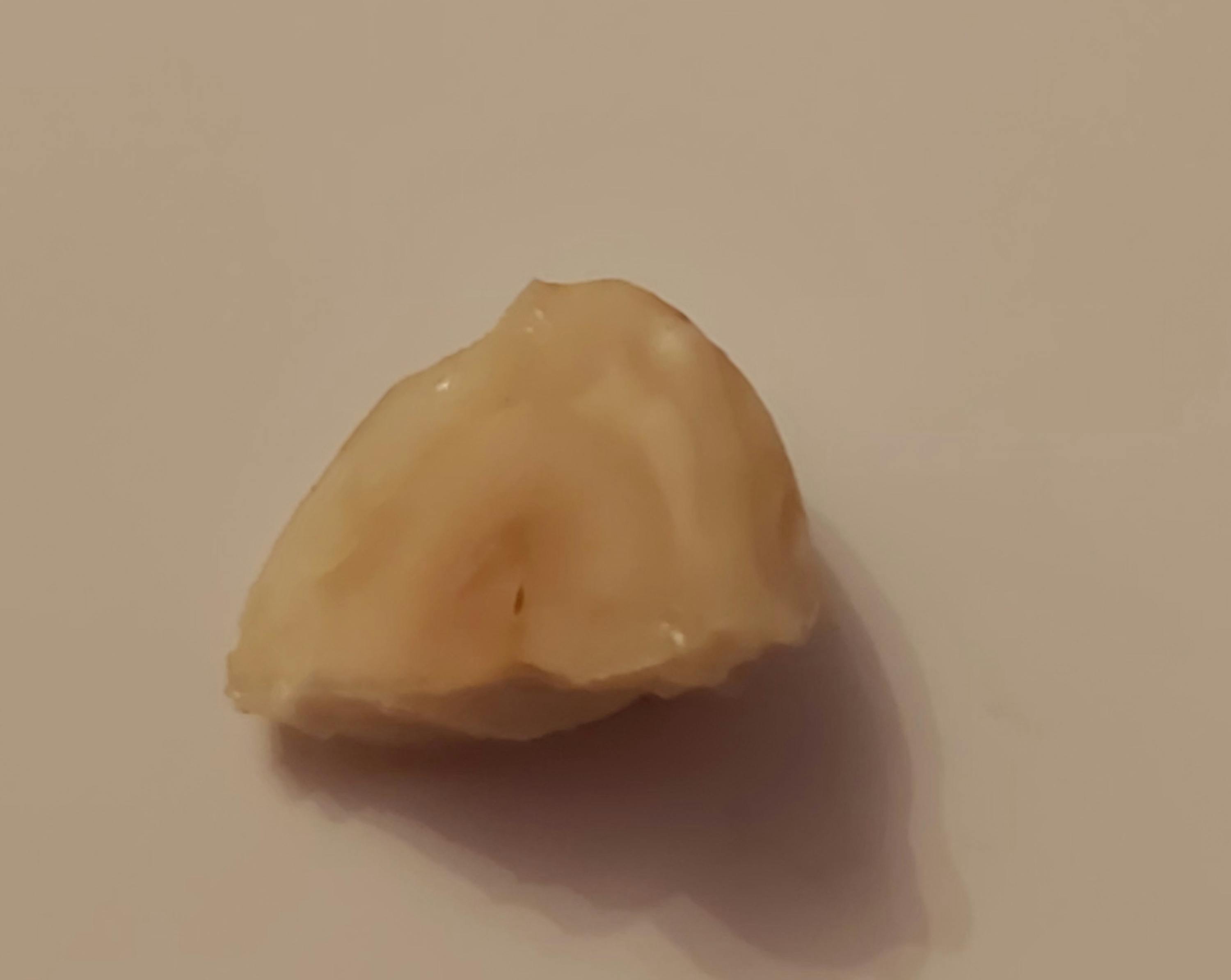 eine Nahaufnahme eines Zahns auf weißem Hintergrund